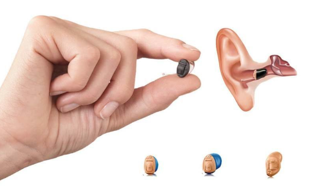 Completely in Canal (CIC) Hearing Aids: Your Go-To 2024 FAQ Guide
