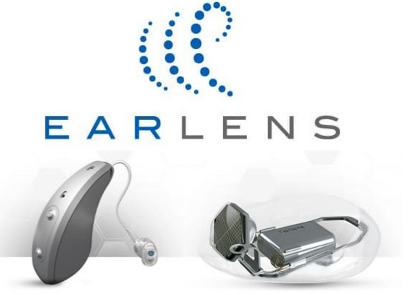 Unlock a World of Sound: The Comprehensive Guide to Earlens Hearing Aids