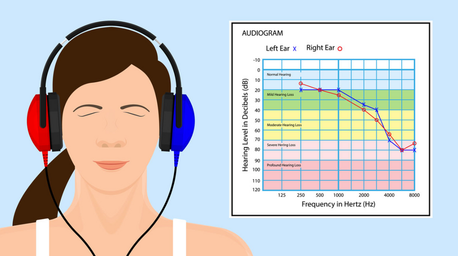 Unearthing the Truth: Do You Need Hearing Aids for Mild Hearing Loss?